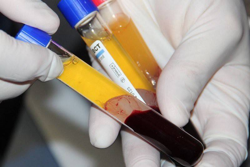 Blood plasma cured several coronavirus patients, says Austrian expert 