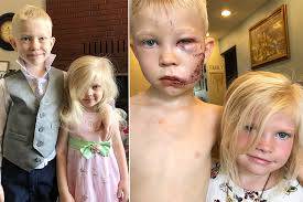 Superheroes praise US 6-year-old who saved sister from dog attack