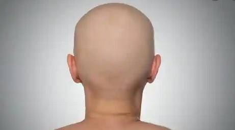 Woman’s head shaved off for ‘stepping out of home’