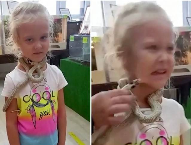 Little girl bitten on face by venomous snake at Russian petting zoo