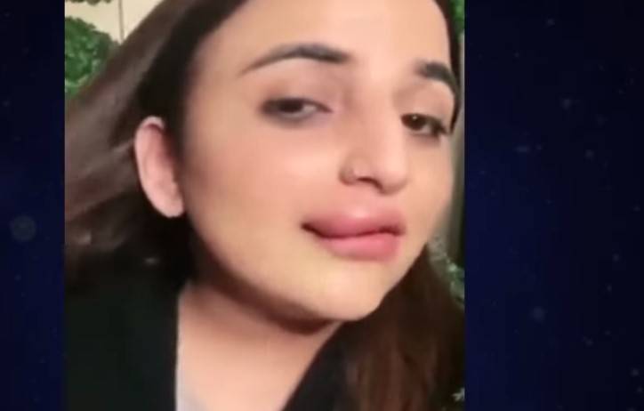 Hareem Shah blames FIA for her half-done lip job