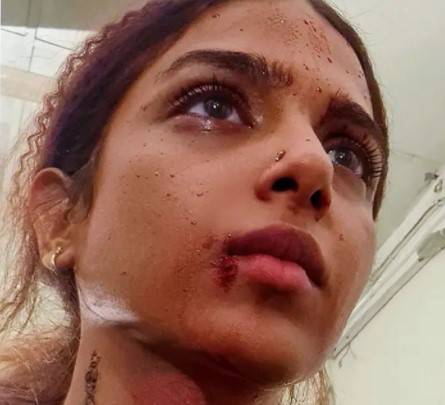 Here’s why Sonya Hussyn’s face is covered with blood 