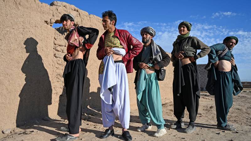 Afghan men who sold their kidneys over a period of the last four years pose for a picture showing their scars from the operation at Sayshanba Bazaar in the Injil district of Herat province. AFP