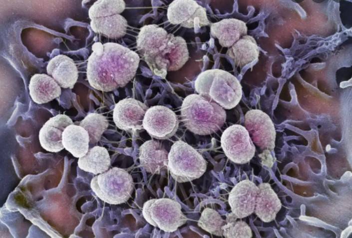 Meningitis vaccine protects against gonorrhoea: studies