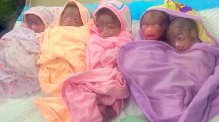 New-born sextuplets in Karachi pass away