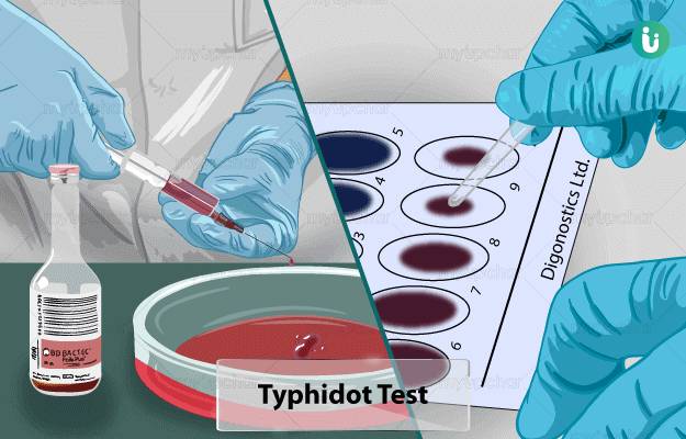 NIH bans laboratories from conducting typhoid tests