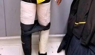 Female mule arrested with ice drug wrapped around her legs