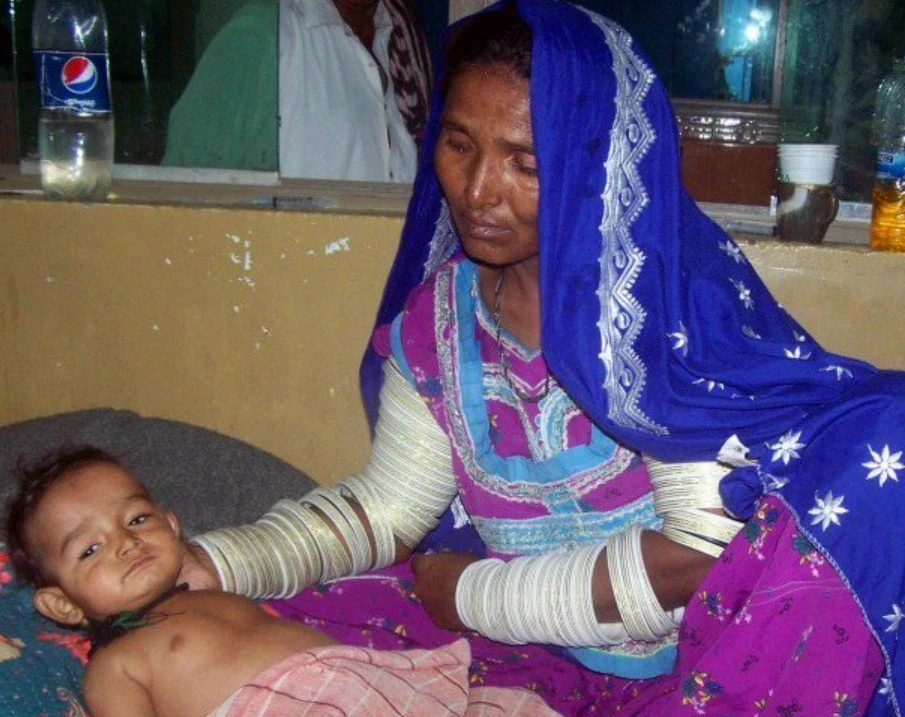 Child malnutrition claims five lives in Mithi