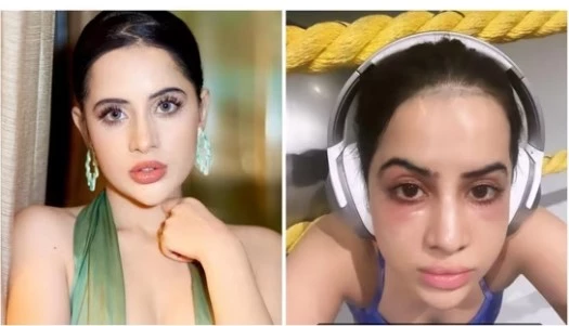 Indian actress Uorfi Javed warns against ‘most painful’ undereye fillers