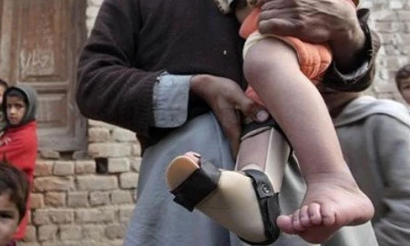 Sixth polio case of the year surfaces in Pakistan