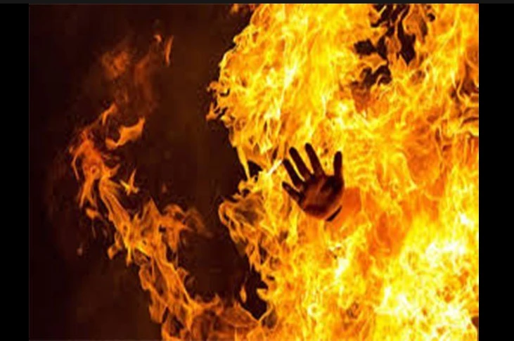 Son-in-law set on fire in Chiniot over tiff with in-laws