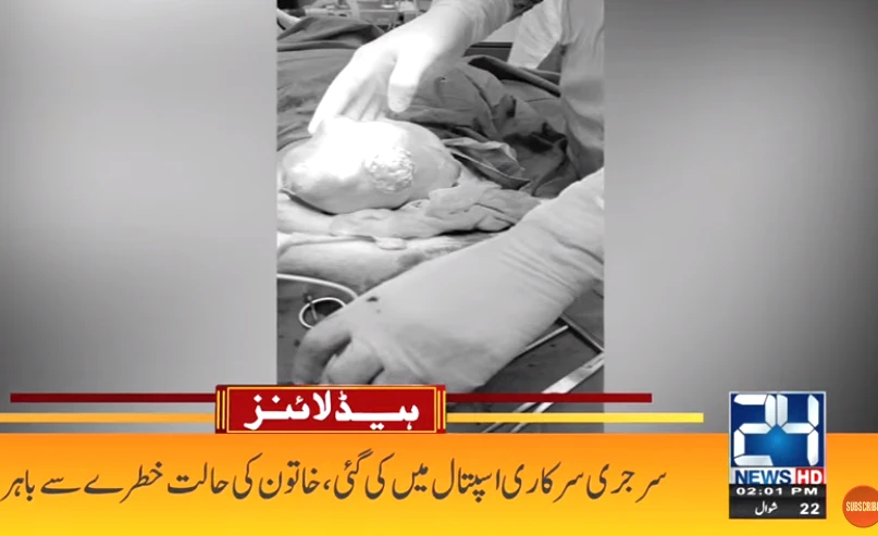 Doctors remove 6kg tumour from woman’s uterus in Narowal