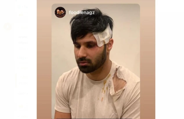 YouTuber Rahim Pardesi injured in attack