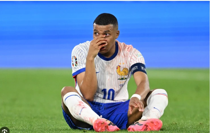 Mbappe breaks nose in France Euro 2024 win