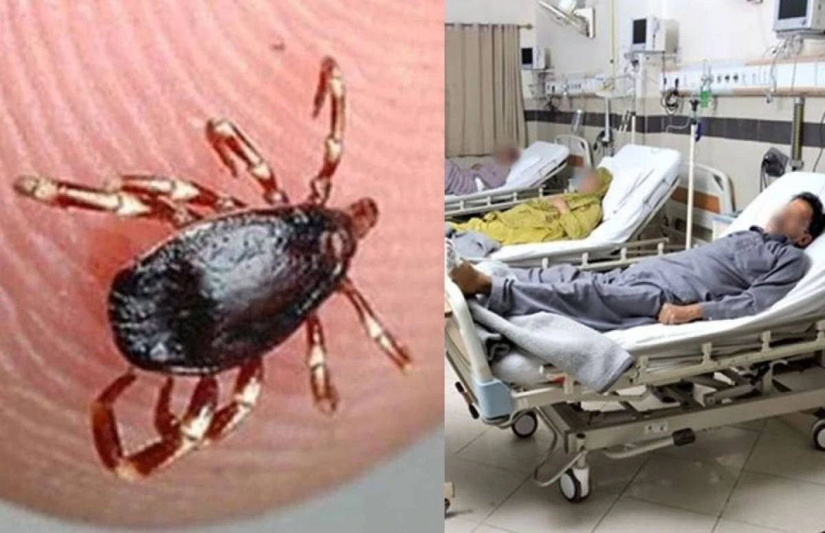 Another case of Congo virus confirmed at Quetta's hospital