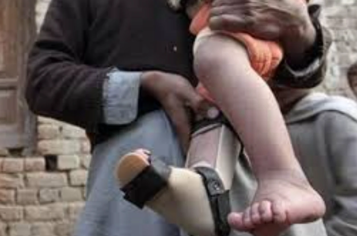 Another polio case surfaces in Balochistan