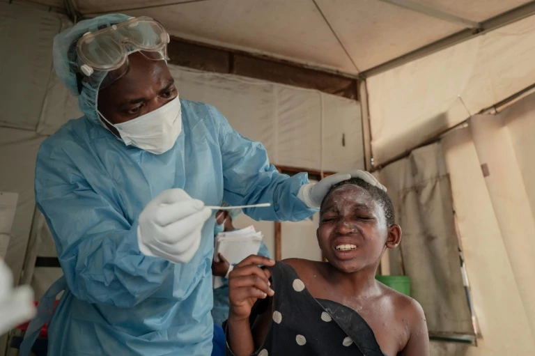 Fear grips east DR Congo as displaced await mpox vaccine