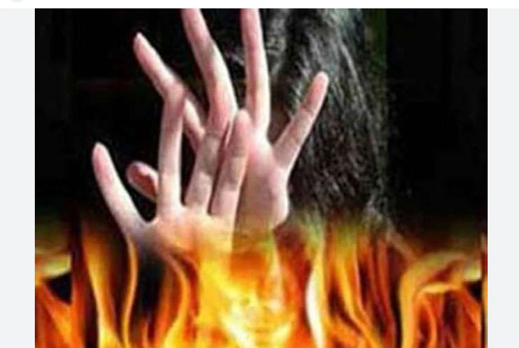 Pregnant woman dies after set on fire by husband in Abbottabad