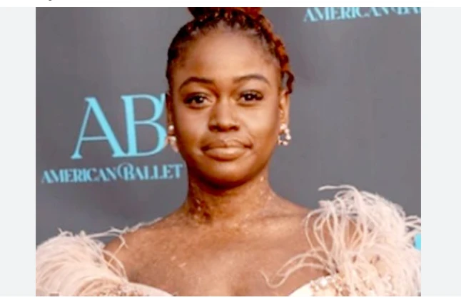 Celebrated ballerina Michaela DePrince dead at 29