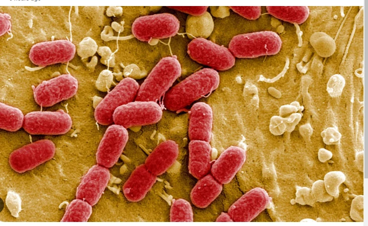 Drug-resistant superbugs projected to kill 39 million by 2050