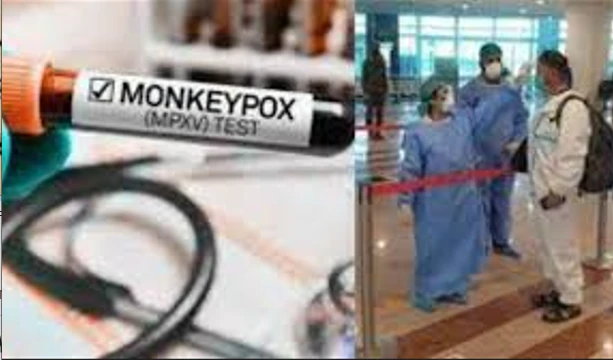 Suspected monkeypox cases detected among 3 passengers arriving Karachi from Saudi Arabia