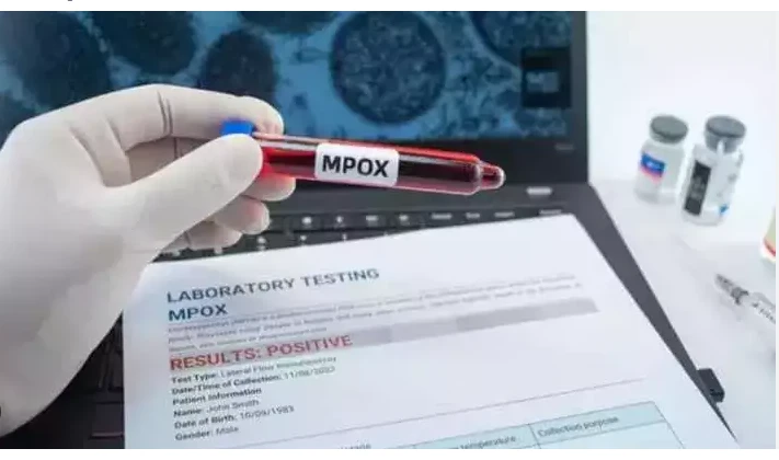 WHO approves first mpox diagnostic test