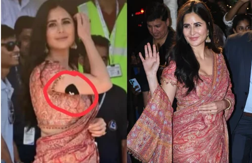 Fans concerned about Katrina’s health condition after finding black patch on her arm