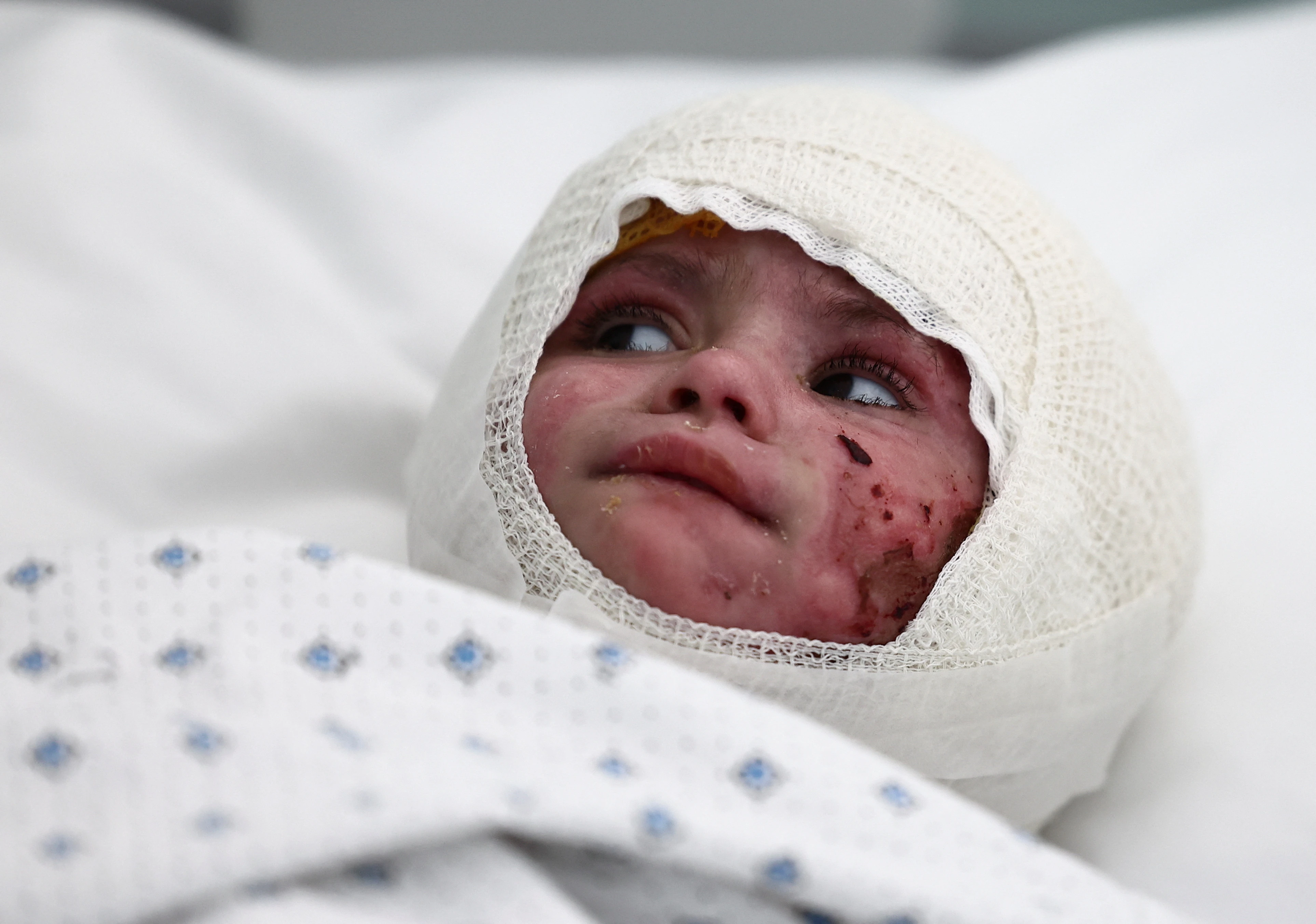 Buried for 14 hours after Israeli strike, Lebanese toddler makes recovery