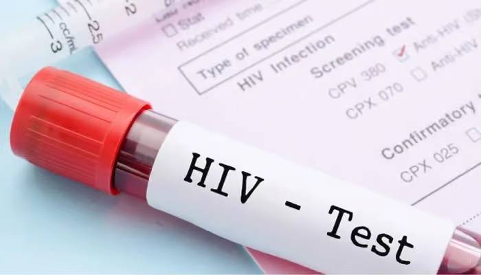 HIV/AIDS spreading in Sindh at alarming rate, report suggests