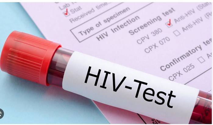 All Punjab hospitals, labs ordered to report HIV cases 