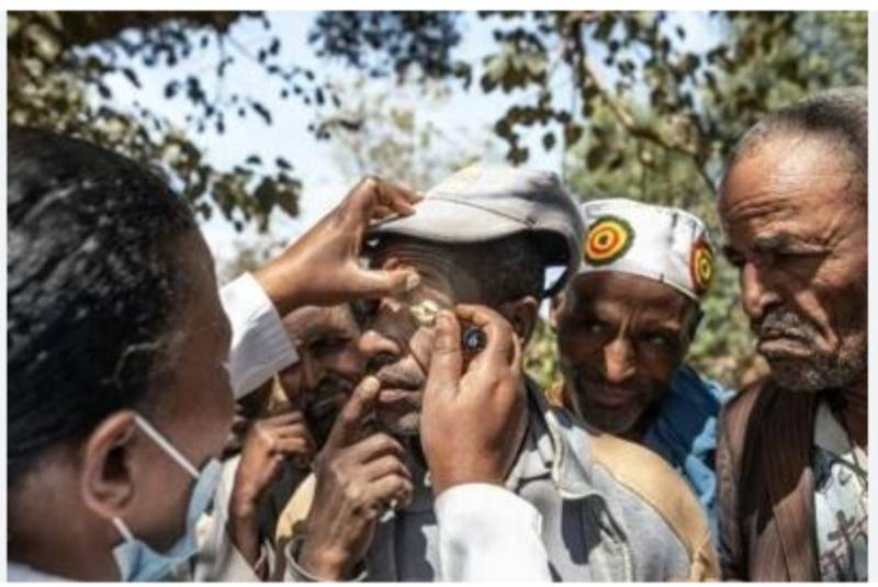 'I rip out my lashes to ease pain': Eye disease afflicts Ethiopia